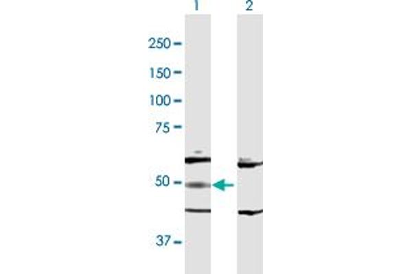 Adenylosuccinate Lyase antibody  (AA 1-484)