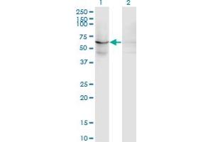 Western Blot analysis of EFHC1 expression in transfected 293T cell line by EFHC1 monoclonal antibody (M09), clone 4E7. (EFHC1 antibody  (AA 270-378))