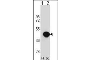 Western blot analysis of BGN (arrow) using rabbit polyclonal BGN Antibody (Center) (ABIN390701 and ABIN2840987). (Biglycan antibody  (AA 148-176))