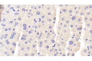 Detection of BGN in Mouse Liver Tissue using Polyclonal Antibody to Biglycan (BGN) (Biglycan antibody  (AA 53-166))