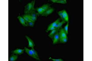 Immunofluorescent analysis of Hela cells using ABIN7142719 at dilution of 1:100 and Alexa Fluor 488-congugated AffiniPure Goat Anti-Rabbit IgG(H+L) (50S Ribosomal Protein L16 (RplP) (AA 1-317) antibody)