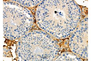 ABIN6263947 and ABIN6272732 at 1/100 staining Mouse testis tissue by IHC-P. (P2RY1 antibody  (C-Term))