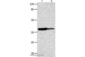 Western blot analysis of Human leiomyosarcoma and liver cancer tissue  , using LPAR4 Polyclonal Antibody at dilution of 1:450