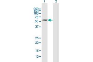 Western Blot analysis of MMP13 expression in transfected 293T cell line by MMP13 MaxPab polyclonal antibody.