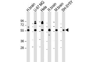 All lanes : Anti-GDI1 Antibody (C-term) at 1:2000 dilution Lane 1: human brain lysate Lane 2: U-87 MG whole cell lysate Lane 3: Hela whole cell lysate Lane 4: rat brain lysate Lane 5: mouse brain lysate Lane 6: SH-SY5Y whole cell lysate Lysates/proteins at 20 μg per lane. (GDI1 antibody  (C-Term))