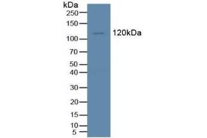 Detection of Tie1 in Human K562 Cells using Polyclonal Antibody to Tyrosine Kinase With Immunoglobulin Like And EGF Like Domains Protein 1 (Tie1) (TIE1 antibody  (AA 435-609))