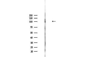 Western blot analysis of lysates from HepG2 cells(heat-shock,45 min treatment), using Cb Antibody at 1/1000 dilution.