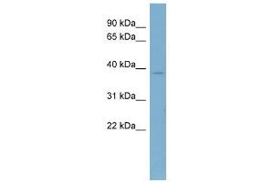 CAB39 antibody used at 1 ug/ml to detect target protein. (CAB39 antibody  (Middle Region))