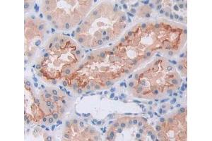 #VALUE! (GRIK2 antibody  (AA 286-561))