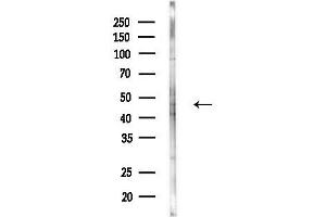 Western blot analysis of lysates from MDA-MB-231 cells(heat-shock, 45 min treatment), using TTRAP Antibody at 1/1000 dilution.