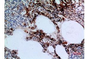 Immunohistochemistry (IHC) analysis of paraffin-embedded Human Lung, antibody was diluted at 1:100. (17beta-HSD4 (N-Term) antibody)