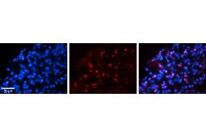 Rabbit Anti-WWP1 Antibody     Formalin Fixed Paraffin Embedded Tissue: Human Pineal Tissue  Observed Staining: Nuclear in pinealocytes  Primary Antibody Concentration: 1:100  Secondary Antibody: Donkey anti-Rabbit-Cy3  Secondary Antibody Concentration: 1:200  Magnification: 20X  Exposure Time: 0. (WWP1 antibody  (N-Term))