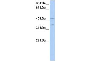 WB Suggested Anti-LASP1 Antibody Titration: 0. (LASP1 antibody  (Middle Region))