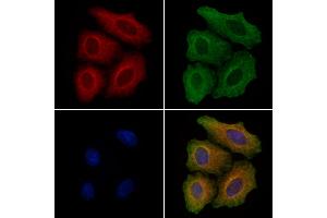 ABIN6260362 and ABIN6277991 staining Hela cells by IF/ICC.