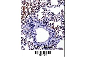 Mouse Hipk4 Antibody immunohistochemistry analysis in formalin fixed and paraffin embedded mouse lung tissue followed by peroxidase conjugation of the secondary antibody and DAB staining. (HIPK4 antibody  (C-Term))