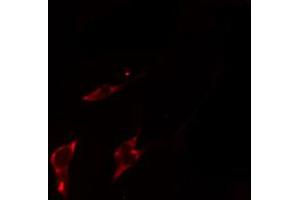ABIN6274522 staining HepG2 cells by IF/ICC. (SERINC1 antibody  (C-Term))