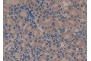 Immunohistochemistry (IHC) image for anti-Complement 4 (C4) (AA 1450-1723) antibody (ABIN7432859)