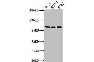 Western Blot Positive WB detected in: Hela whole cell lysate, MCF-7 whole cell lysate, K562 whole cell lysate All lanes: EVC antibody at 2 μg/mL Secondary Goat polyclonal to rabbit IgG at 1/50000 dilution Predicted band size: 112 kDa Observed band size: 112 kDa (EVC antibody  (AA 493-602))