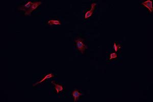 ABIN6266622 staining CACO-2 cells by IF/ICC. (PDGFRA antibody  (Internal Region))
