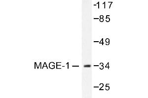 Image no. 1 for anti-Melanoma Antigen Family A, 1 (Directs Expression of Antigen MZ2-E) (MAGEA1) antibody (ABIN265510)