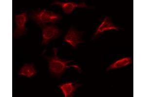 ABIN6266461 staining Hela by IF/ICC. (RAF1 antibody  (pSer301))