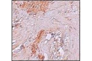 Immunohistochemistry of RBM35A in Human colon tissue with RBM35A antibody at 2.