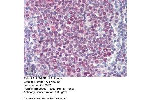 Immunohistochemistry with Human Tonsil lysate tissue at an antibody concentration of 5. (TGFB1I1 antibody  (N-Term))
