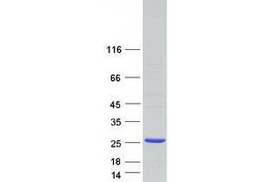Validation with Western Blot (RPP25 Protein (Myc-DYKDDDDK Tag))