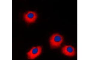 Immunofluorescent analysis of ERAS staining in Jurkat cells. (ERAS antibody  (C-Term))