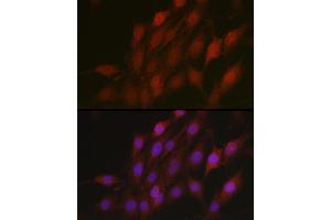 Immunofluorescence analysis of C6 cells using β-TrCP/BTRC Rabbit pAb (ABIN3022333, ABIN3022334, ABIN3022335 and ABIN6218745) at dilution of 1:100 (40x lens). (BTRC antibody  (AA 50-340))