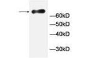 Image no. 1 for anti-General Transcription Factor IIA, 1-Like (GTF2A1L) antibody (ABIN791472) (GTF2A1L antibody)