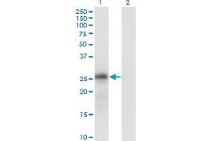 Western Blot analysis of KLK6 expression in transfected 293T cell line by KLK6 monoclonal antibody (M01), clone 4A10.