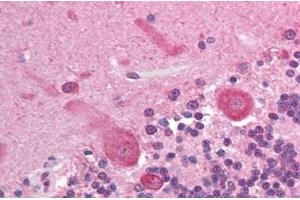 Immunohistochemistry (IHC) image for anti-V-Akt Murine Thymoma Viral Oncogene Homolog 3 (Protein Kinase B, Gamma) (AKT3) (AA 119-136) antibody (ABIN302246) (AKT3 antibody  (AA 119-136))