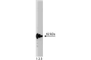 Western blot analysis of p62 Ick ligand on a HCT-8 (human colorectal adenocarcinoma, ATCC CCL-244) cell lysate. (p62 Lck Ligand (AA 257-437) antibody)