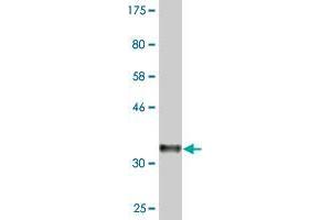 Western Blot detection against Immunogen (36. (PUM2 antibody  (AA 701-798))