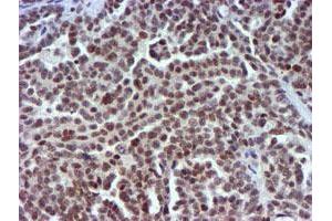 Image no. 6 for anti-Ubiquitin Specific Peptidase 7 (Herpes Virus-Associated) (USP7) antibody (ABIN1498592) (USP7 antibody)