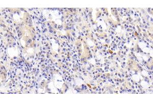 Detection of JAK3 in Human Small intestine Tissue using Polyclonal Antibody to Janus Kinase 3 (JAK3)