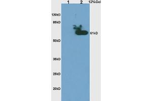 L1 rat brain lysates, L2 human colon carcinoma lysates probed with Anti- Phospho-CHK2(Thr68) Polyclonal Antibody, Unconjugated (ABIN703165) at 1:200 in 4 °C. (CHEK2 antibody  (pThr68))