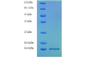 SDS-PAGE (SDS) image for S100 Calcium Binding Protein A8 (S100A8) (AA 2-89) protein (His tag) (ABIN5710302)