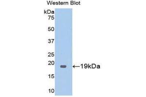 Western Blotting (WB) image for anti-Thrombomodulin (THBD) (AA 325-481) antibody (ABIN1173036) (Thrombomodulin antibody  (AA 325-481))
