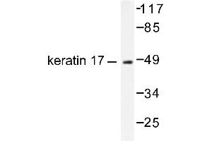 Image no. 1 for anti-Keratin 17 (KRT17) antibody (ABIN265496)