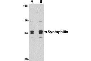Western Blotting (WB) image for anti-Syntaphilin (SNPH) (Middle Region) antibody (ABIN1031114) (Syntaphilin antibody  (Middle Region))