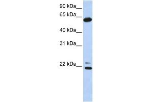 WB Suggested Anti-CCT5 Antibody Titration: 0. (CCT5 antibody  (C-Term))