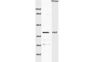L1 mouse intestine lysates probed with Anti TNFR1/TNF Receptor I Polyclonal Antibody, Unconjugated (ABIN682018) at 1:200 overnight at 4 °C. (TNFRSF1A antibody  (AA 1-100))