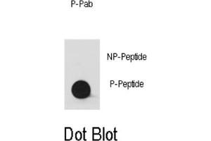 Dot Blot (DB) image for anti-V-Yes-1 Yamaguchi Sarcoma Viral Oncogene Homolog 1 (YES1) (pTyr530), (pTyr537) antibody (ABIN2970974) (YES1 antibody  (pTyr530, pTyr537))