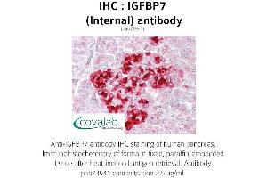 Image no. 1 for anti-Insulin-Like Growth Factor Binding Protein 7 (IGFBP7) (Internal Region) antibody (ABIN1735789) (IGFBP7 antibody  (Internal Region))