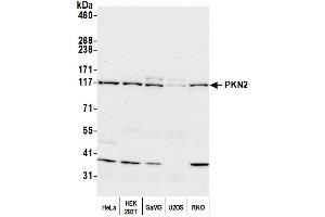 anti-Protein Kinase N2 (PKN2) (AA 200-250) antibody