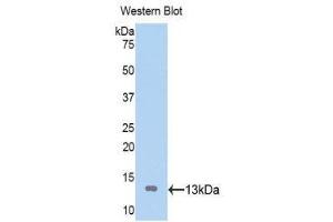 Western Blotting (WB) image for anti-ATPase, H+/K+ Exchanging, alpha Polypeptide (ATP4A) (AA 798-896) antibody (ABIN1176528) (ATP4A antibody  (AA 798-896))