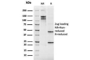SDS-PAGE (SDS) image for anti-Integrin beta 3 (ITGB3) (AA 385-490) antibody (ABIN6939828)