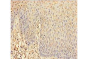 Immunohistochemistry of paraffin-embedded human tonsil tissue using ABIN7144104 at dilution of 1:100 (ANGPTL2 antibody  (AA 23-493))